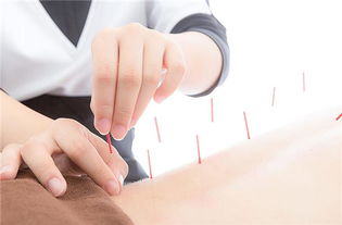 針灸推拿培訓(xùn),重慶推拿培訓(xùn),重慶康復(fù)理療培訓(xùn), 重慶康立中醫(yī)康復(fù)職業(yè)培訓(xùn)學(xué)校