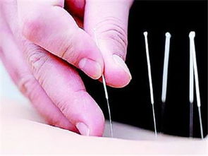 針灸的科學依據 傳統醫學與現代研究的交融