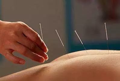 廣東醫保新舉措 針灸推拿納入報銷，助力中醫藥發展