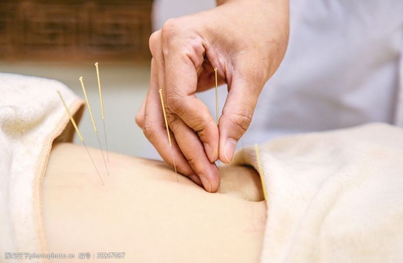 針灸 古老智慧的養身之道