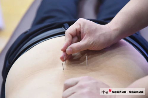 元氣針灸，針道無極 一場讓師友直呼“太值了”的精品講座