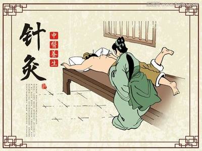 非遺丨扁鵲狄仁杰的“神之一針” 斗魚帶你認(rèn)識(shí)中華醫(yī)術(shù)針灸