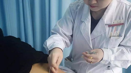 世界針灸日 讓綠色療法服務(wù)更多人