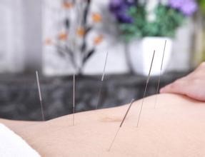 奇氏陰陽(yáng)針灸無(wú)痛減肥療法 面部微雕與體雕的專(zhuān)業(yè)培訓(xùn)解析