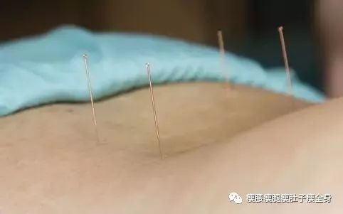 針灸減肥 至少半年的堅(jiān)持與效果