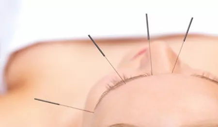 針灸減肥會(huì)反彈嗎？如何科學(xué)避免反彈