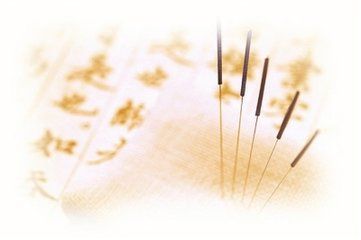 針灸 自然的療愈之道